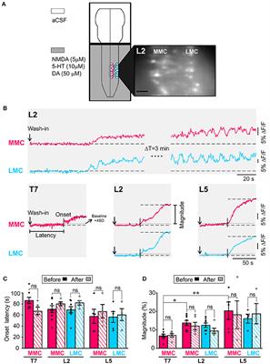 Influence of Brain Stem on Axial and Hindlimb Spinal Locomotor Rhythm Generating Circuits of the Neonatal Mouse